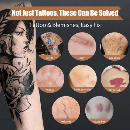VANERIA Body Concealer Kit - Tattoo Cover Up Makeup, Waterproof &amp; Long - Lasting - Conceal Scars, Spots &amp; Vitiligo, Birthmarks - All Skin Tones