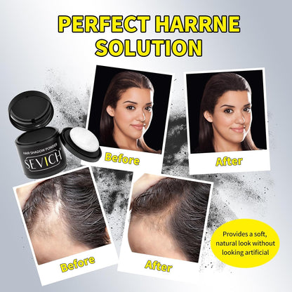 Sevich Hairline Powder 10g Large Capacity,Instantly Conceals Hair Loss,Root Touch up Powder,Hair Shadow Toppers for Women &amp; Men Thinning Gray Hair,48H Makeup Lasting,1 Box = 2.5 Boxes,Dark Brown
