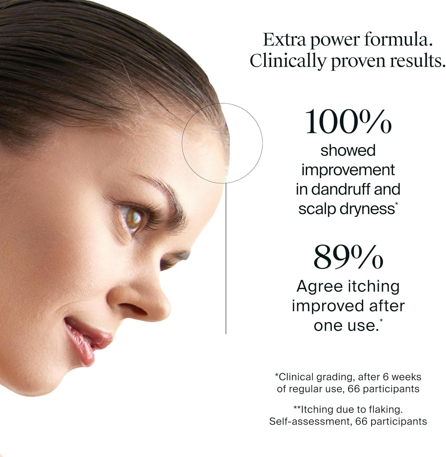 Neutrogena T/Gel Scalp Relief: A Straight‑Talk Review