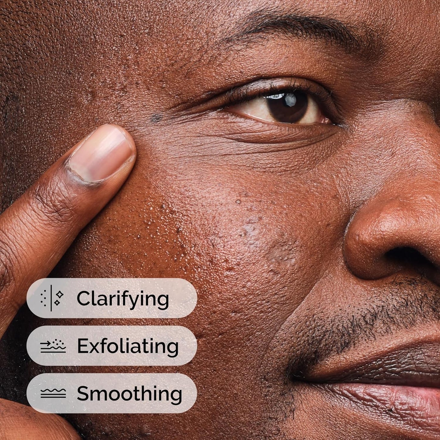 Finding a calm in the chaos of oily skin