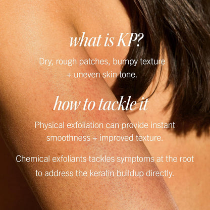 First Aid Beauty - KP Bump Eraser Body Scrub with 10% AHA, Keratosis Pilaris Exfoliater with Glycolic and Lactic acids, Helps Reduce Chicken Skin Bumps, Safe for Sensitive Skin, Strawberry Scent, 226g