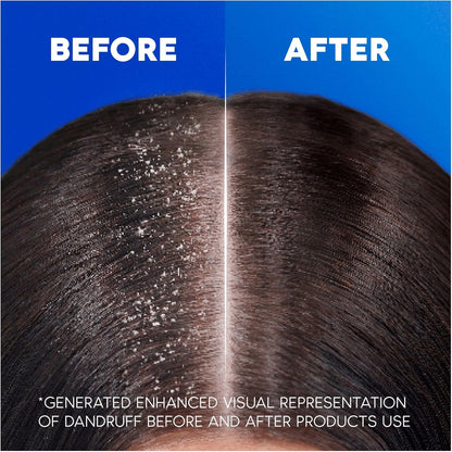 A fresh take on dandruff‑free days